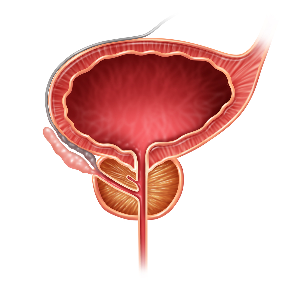 prostate probleum