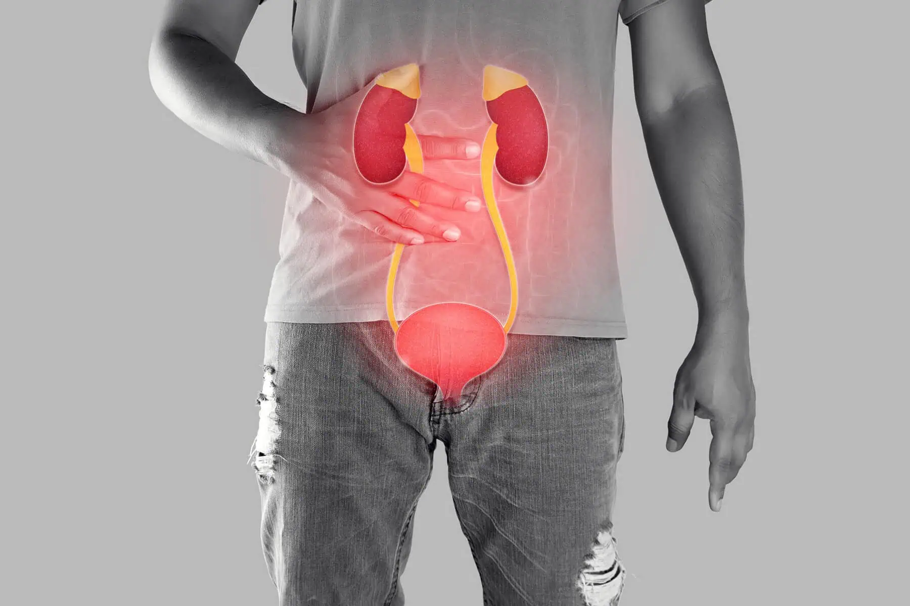 uretheral stricture